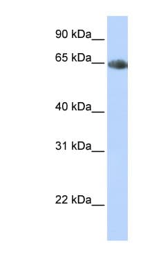 Polyclonal Rabbit anti-Human SLC6A2 / NET Antibody (aa396-445, IHC, WB)