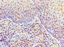 ITGA9 / Integrin Alpha 9 Antibody (aa30-250)
