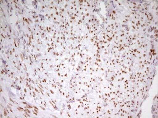 Monoclonal Mouse anti-Human MEF2D Antibody (clone OTI1E11, aa1-282, IHC, WB)