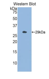 CHI3L1 / YKL-40 Antibody (aa112-356, FITC)
