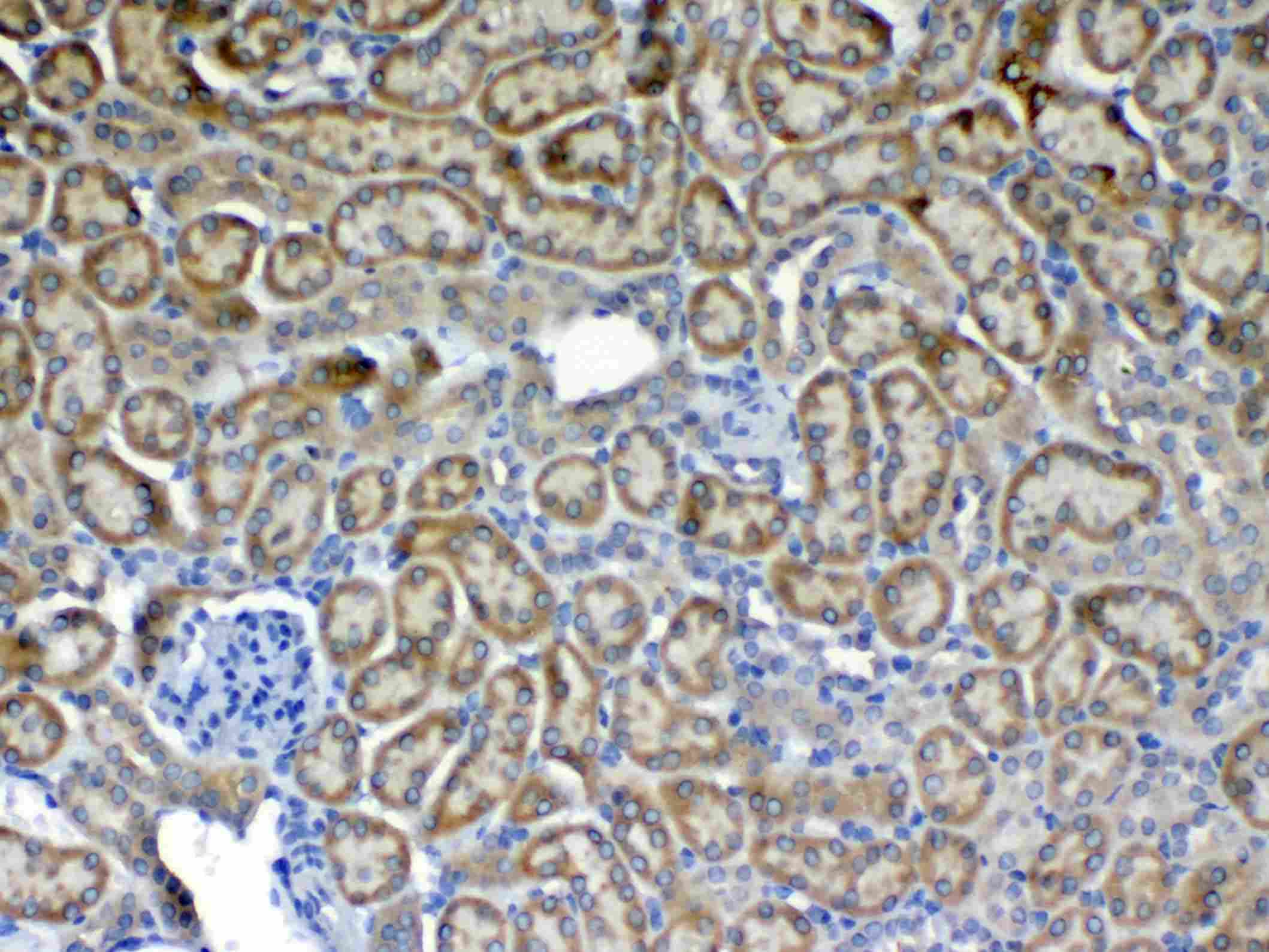 Polyclonal Rabbit anti-Mouse CD135 / FLT3 Antibody (IHC, WB)