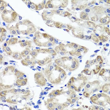 Polyclonal Rabbit anti-Human MAPKBP1 Antibody (IHC, WB)