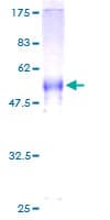 Human CABP / CABP1 Protein (Recombinant GST)