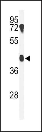 B4GALT2 Antibody (aa290-318)