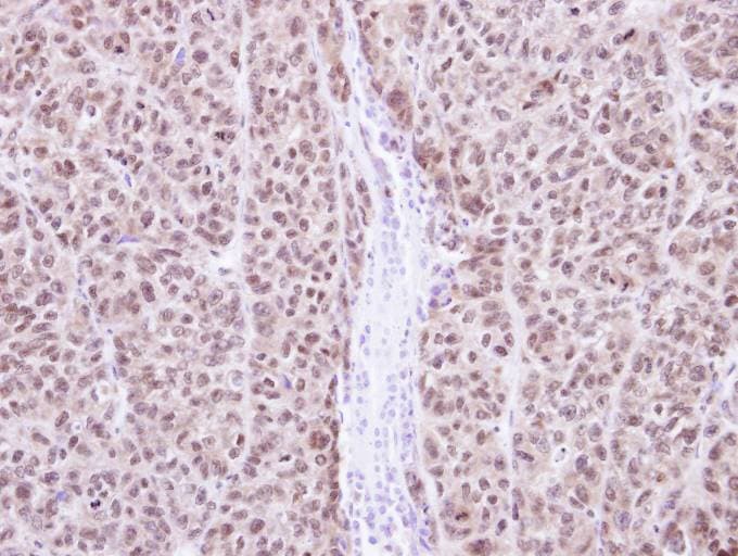 Polyclonal Rabbit anti-Human RAG2 / RAG-2 Antibody (aa271-527, IHC, WB)