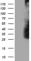 ARH / LDLRAP1 Antibody (clone OTI1F3, Carrier-free)