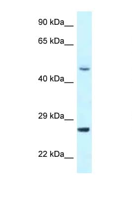 CDK20 / CCRK Antibody (N-Terminus)