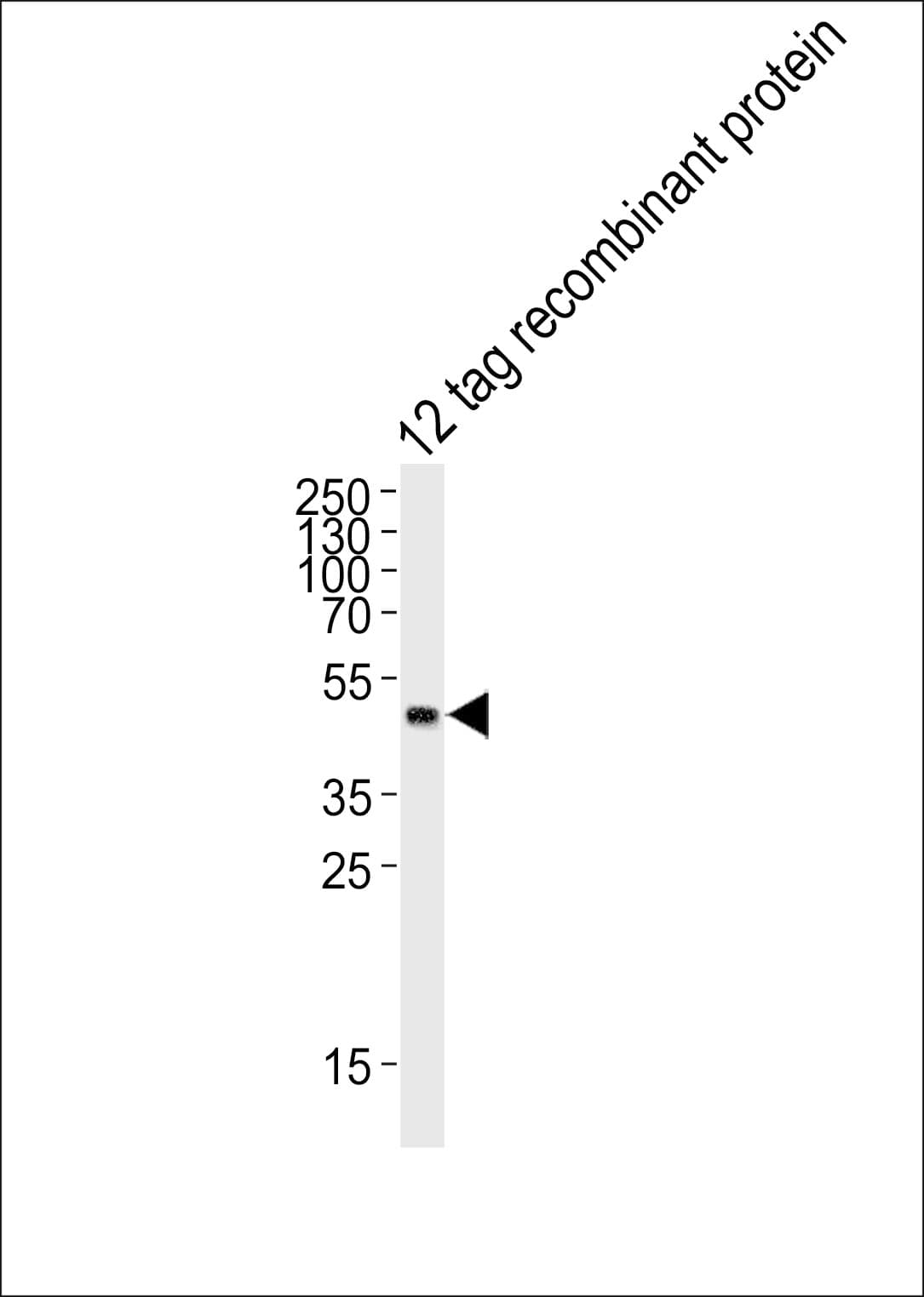 GST Tag Antibody