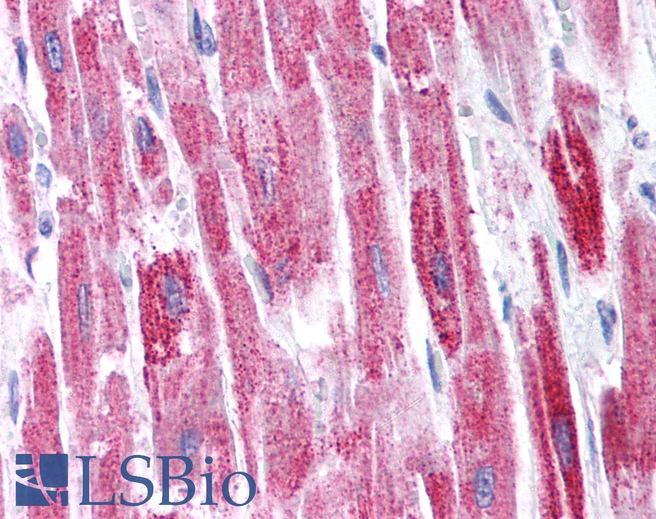 Polyclonal Rabbit anti-Human KCTD13 Antibody (aa26-75, IHC, WB)