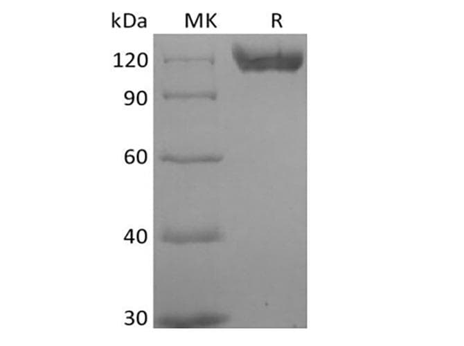 Human CD22 Protein (Recombinant AVI-6His, C-terminus)