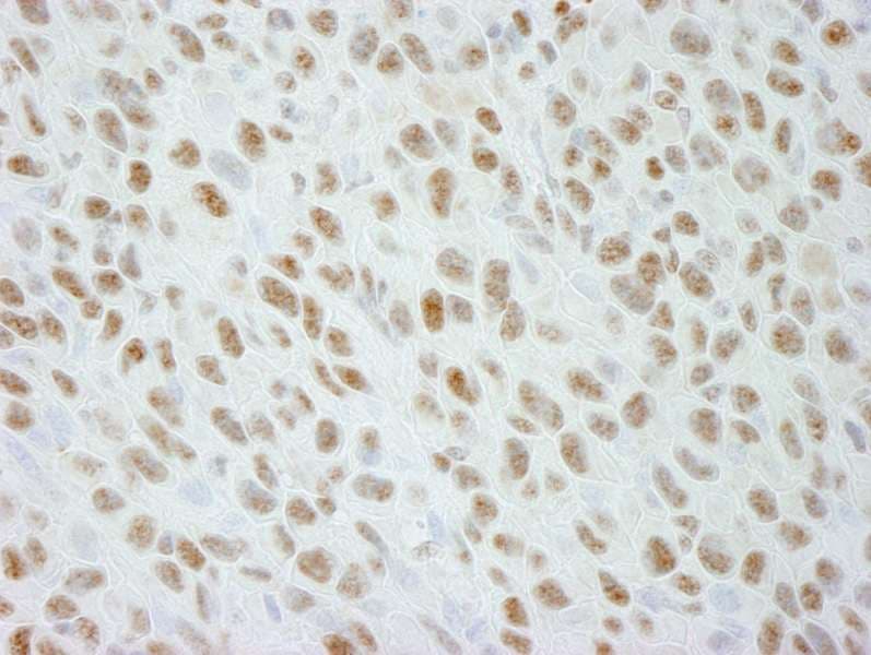 Polyclonal Rabbit anti-Human DDX21 Antibody (aa725-C-term, IHC)