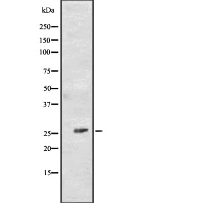 CD81 Antibody