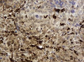 TP / Thymidine Phosphorylase Antibody (clone OTI5B11)