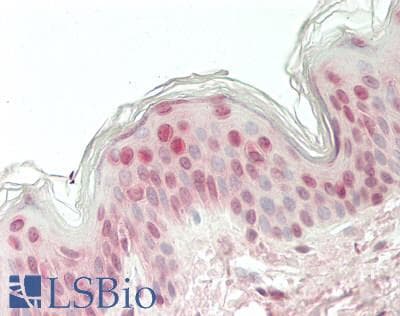 IHC-plus™ UBE2I / UBC9 Antibody (clone 1B10)