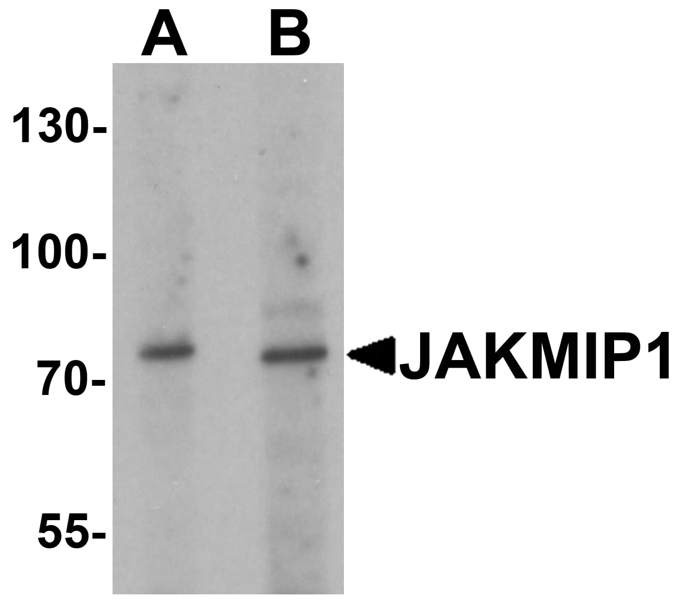 IHC-plus™ JAKMIP1 Antibody