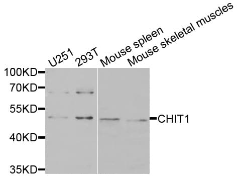 Polyclonal Rabbit anti-Human CHIT1 / Chitotriosidase Antibody (IHC, WB)