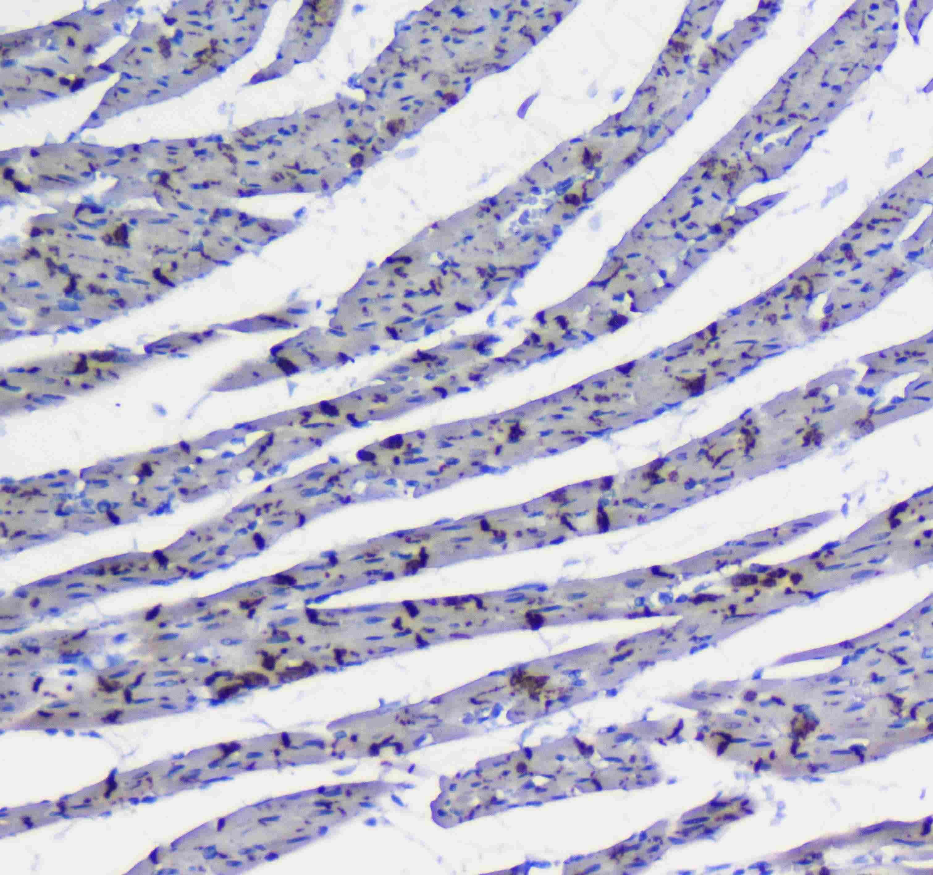 Polyclonal Rabbit anti-Human ITGA5/Integrin Alpha 5/CD49e Antibody (IHC, WB)