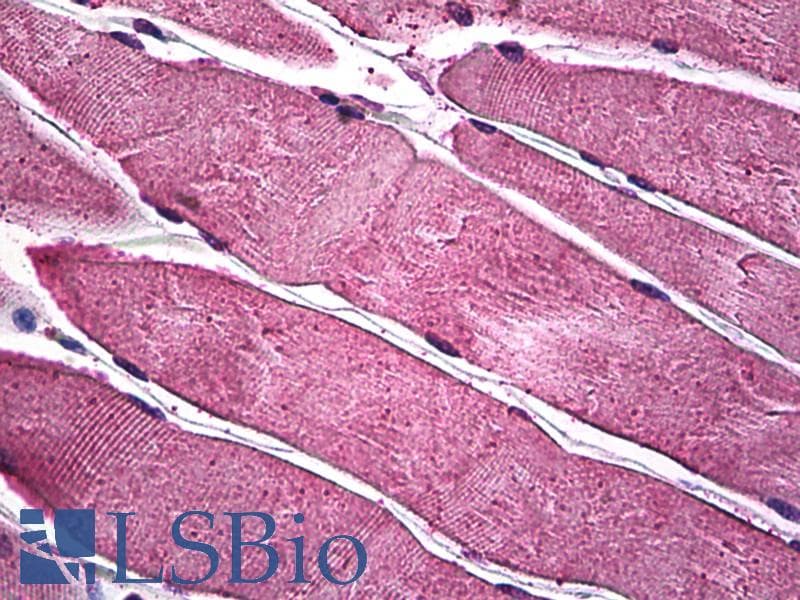 IHC-plus™ PIM1 / Pim-1 Antibody (clone 6A2)