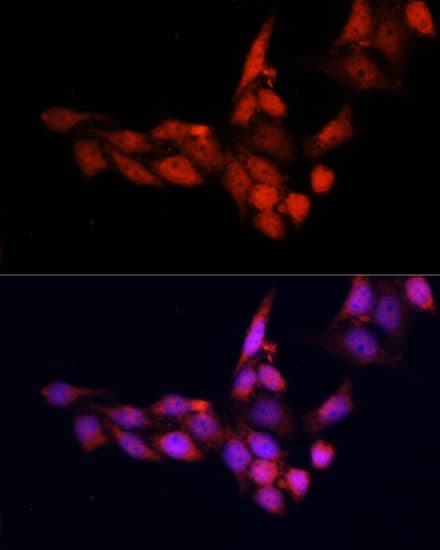 SIRT1 / Sirtuin 1 Antibody