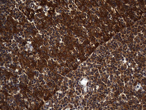 ALDH7A1 Antibody (clone OTI1A9, Carrier-free)