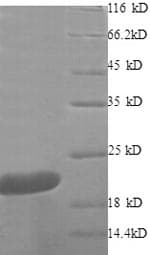 Human TNF Alpha Protein (Recombinant 6His, N-terminus)