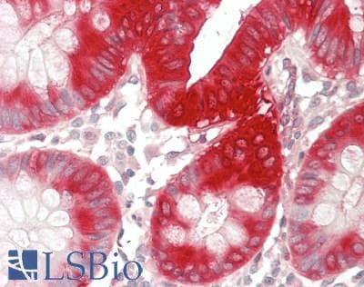 IHC-plus™ PTGS2 / COX2 / COX-2 Antibody (C-Terminus)