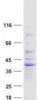 Human RIMS3 Protein (Recombinant Myc-DDK (Flag))
