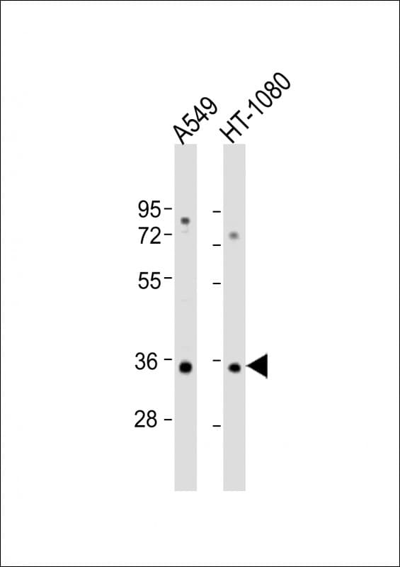 RSPO3 Antibody (aa214-248)