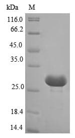 Nostoc alr2278 Protein (Recombinant 10His, N-terminus + Myc, C-terminus)