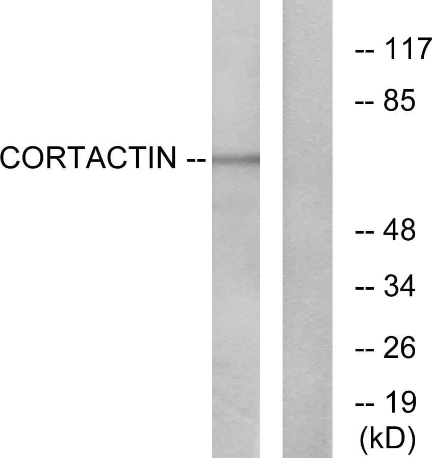 IHC-plus™ CTTN / Cortactin Antibody (aa388-437)