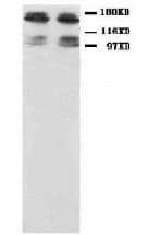 GRIN2B / NMDAR2B / NR2B Antibody (N-Terminus)