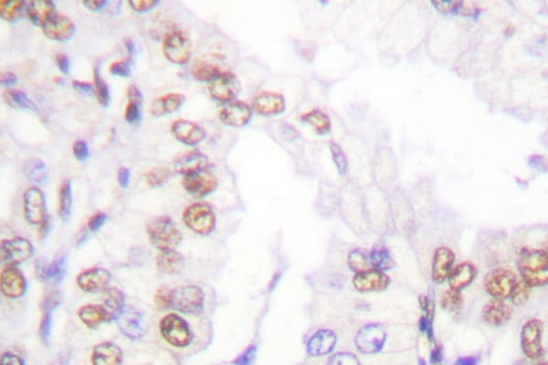 SENP5 Antibody (Leu681)