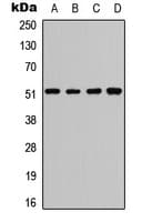 Polyclonal Rabbit anti-Human ATF2 Antibody (N-Terminus, IHC, WB)