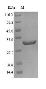 Human Delta-6 Desaturase / FADS2 Protein (Recombinant 6His-SUMO, N-terminus)