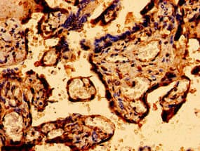 Polyclonal Rabbit anti-Human MCU / CCDC109A Antibody (IHC, WB)