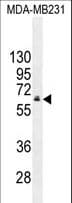 Polyclonal Rabbit anti-Human HNF1B / HNF1 Beta Antibody (aa498-529, WB)