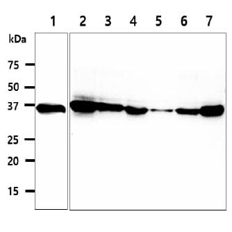 Monoclonal Mouse anti-Human CPOX Antibody (clone AT36B10, WB)