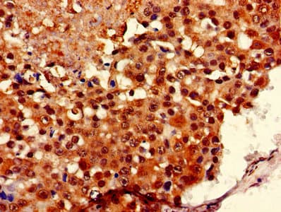 Polyclonal Rabbit anti-Human COA1 Antibody (IHC)