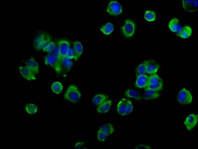 Polyclonal Rabbit anti-Human OCLN / Occludin Antibody (IHC, IF, WB)