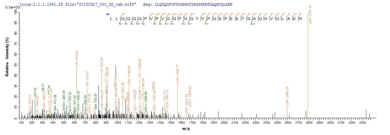 Human NRL Protein (Recombinant 10His, N-terminus + Myc, C-terminus)