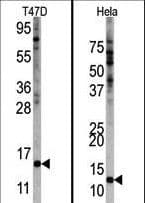 Polyclonal Rabbit anti-Human FAU / Fub1 Antibody (aa60-93, IHC, WB)