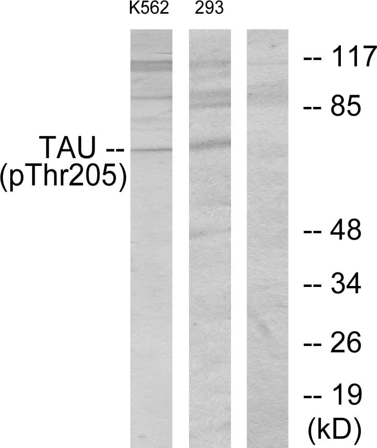 MAPT / Tau Antibody (phospho-Thr205)
