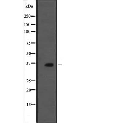 Polyclonal Rabbit anti-Human WDR83 Antibody (WB)