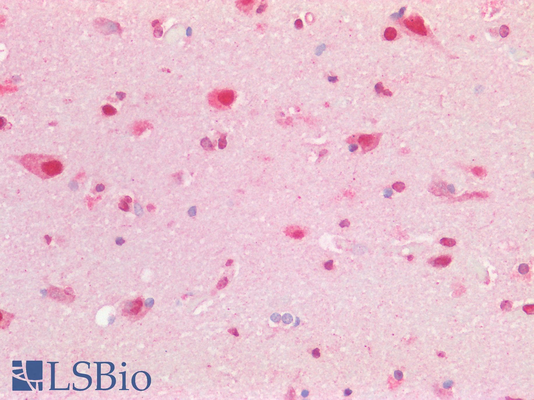 AATF Antibody (aa171-220)