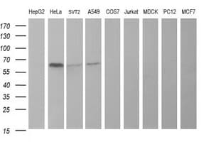 PathPlus™ TH / Tyrosine Hydroxylase Antibody (clone OTI3H3)