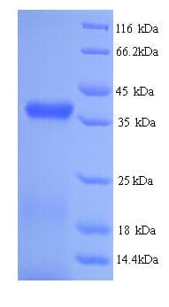 Bovine RBP3 / IRBP Protein (Recombinant His)