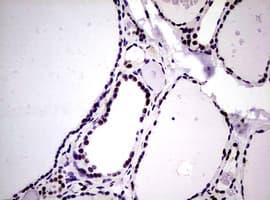 Monoclonal Mouse anti-Human NBN / Nibrin Antibody (clone OTI8E7, IHC, WB)