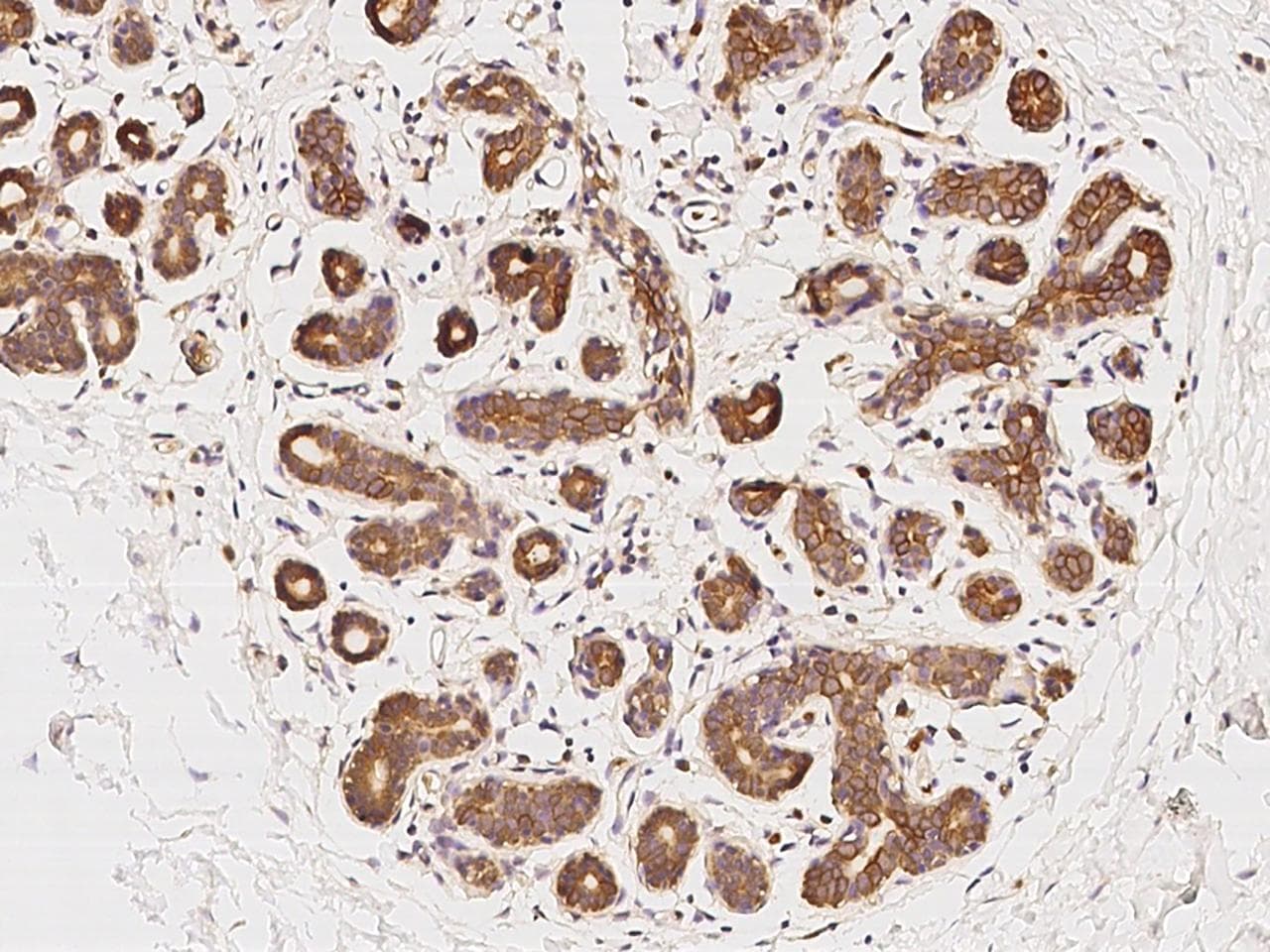 Polyclonal Rabbit anti-Human (CYREN) C7orf49 Antibody (IHC)