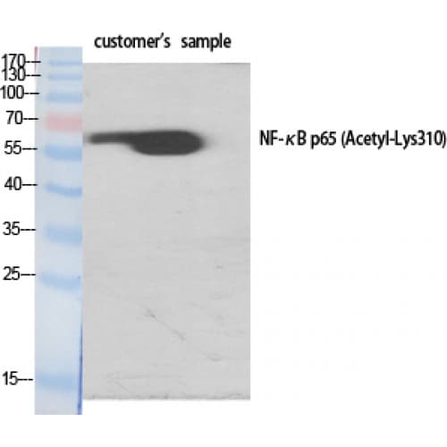 RELA / NFKB p65 Antibody (250-330 aa)