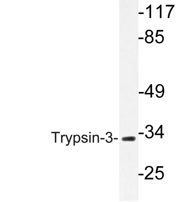 PRSS3 / Trypsin 3 Antibody (aa117-166)